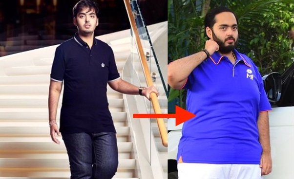 Anant Ambani Krankheit