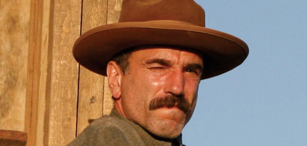 Daniel Day-Lewis Krankheit